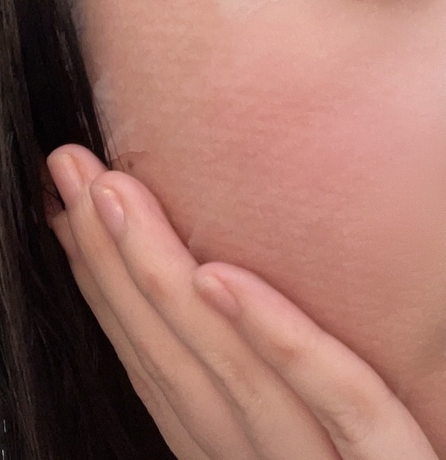 ごめんね素肌マスク/クリアターン/シートマスク・パックを使ったクチコミ（2枚目）