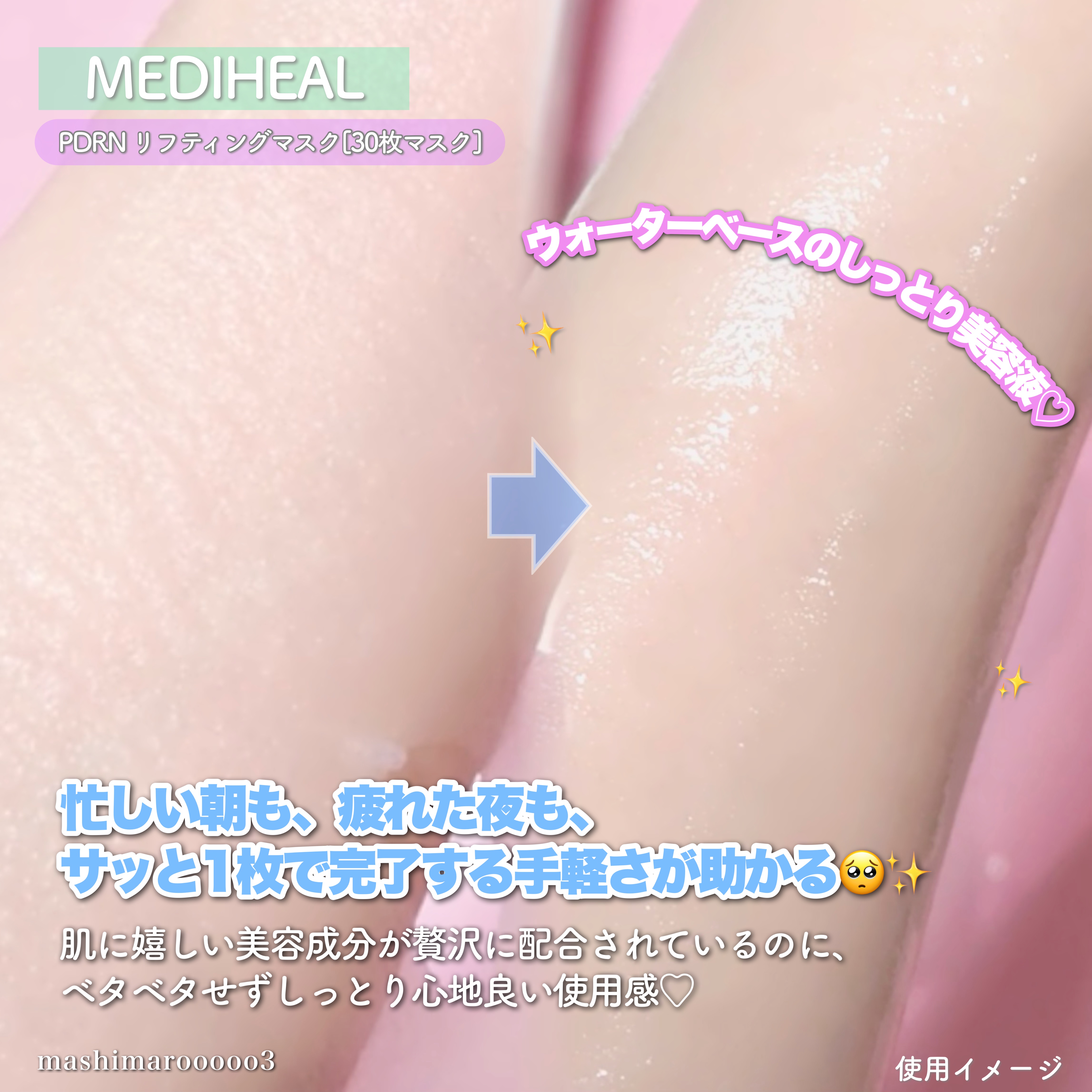 PDRN リフティングマスク/MEDIHEAL/シートマスク・パックを使ったクチコミ（3枚目）