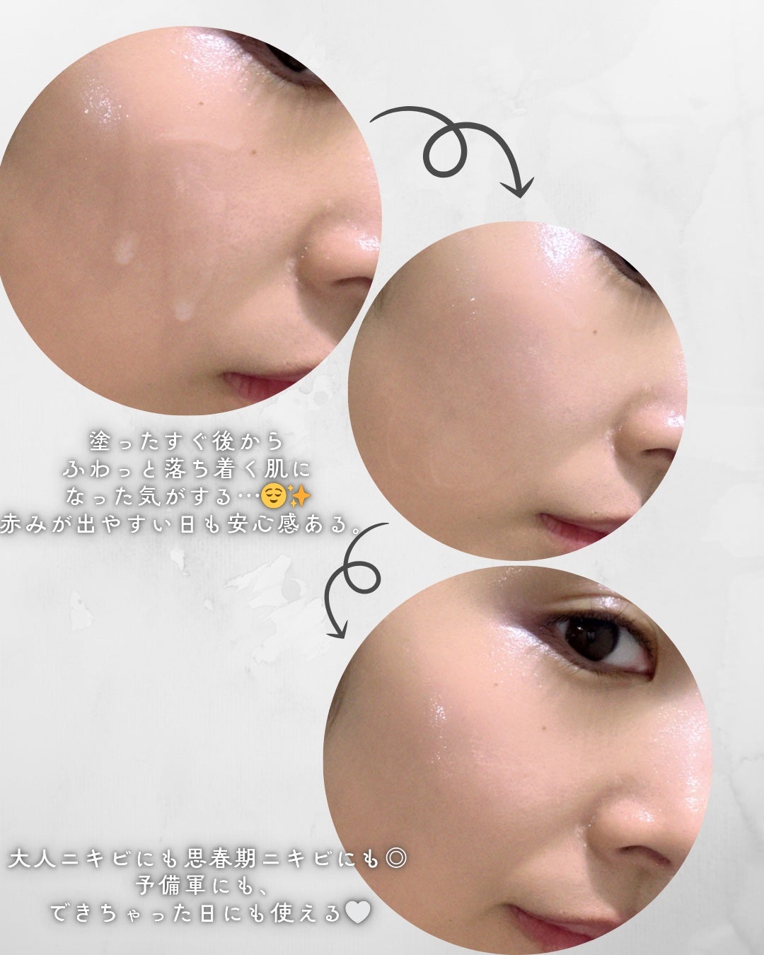 ベルプリモ ACコンフォートエッセンス/BELPRIMO/美容液を使ったクチコミ(4枚目)