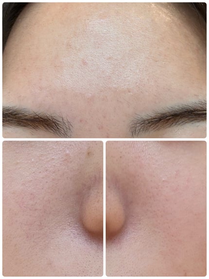 モーニングジェルウォッシュ/ビトレスキン/その他洗顔料を使ったクチコミ(3枚目)