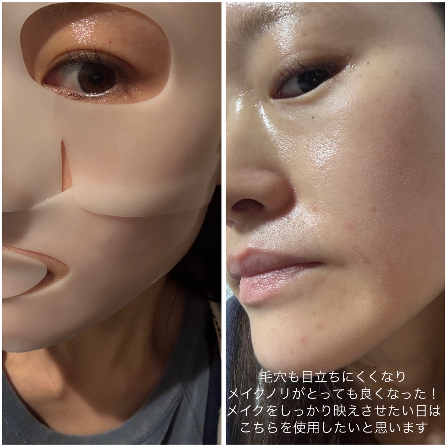 SUPER GLOW DEEP COLLAGEN BUBBLE SERUM/SKINEGO/美容液を使ったクチコミ(6枚目)