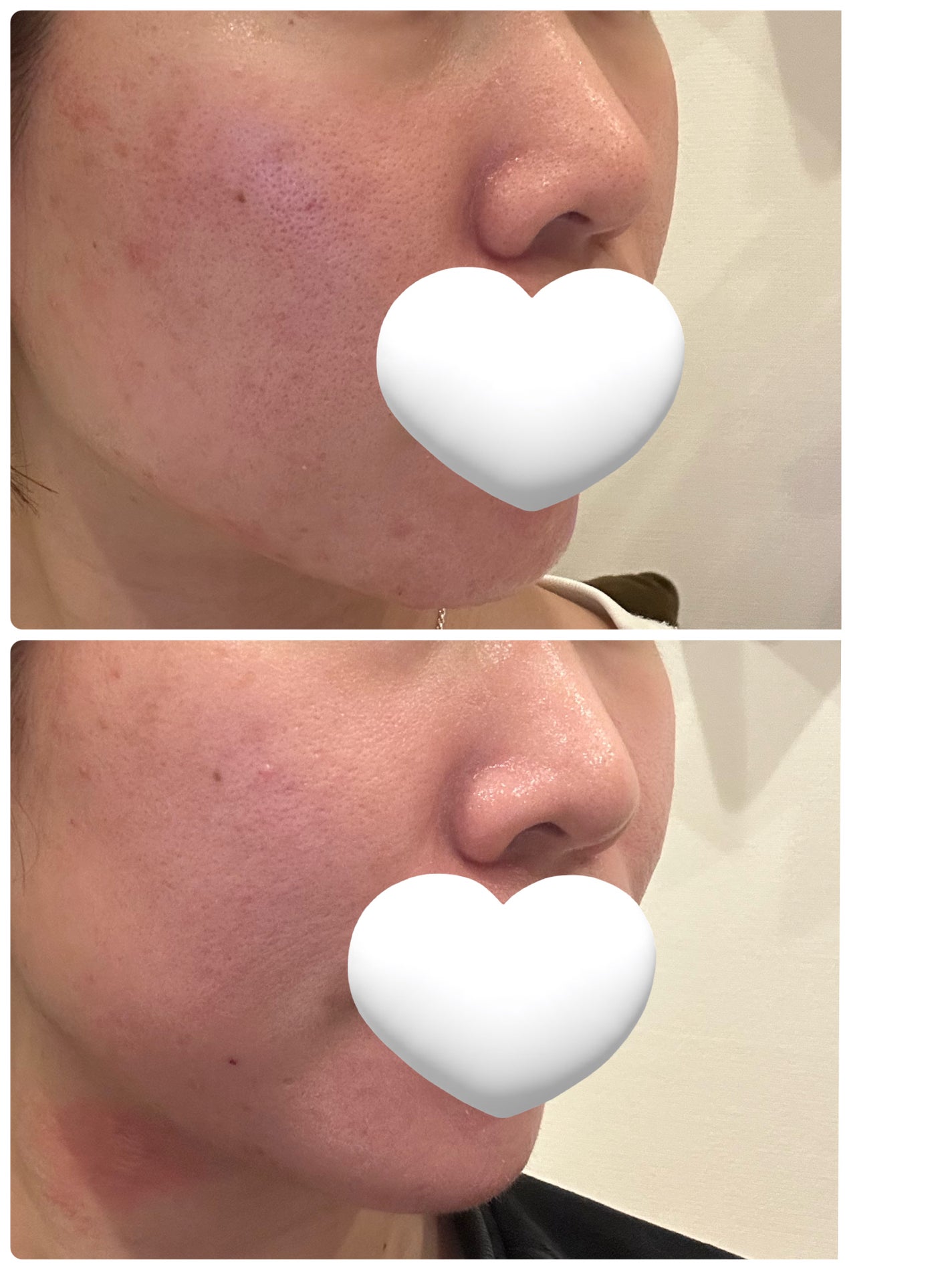 ビタミンミルク/ASUNE /乳液を使ったクチコミ(1枚目)