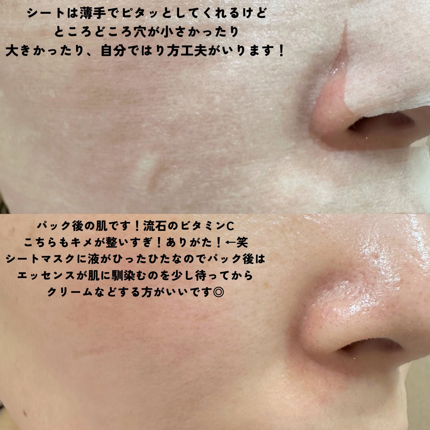 ルルルン ハイドラ AZ マスク/ルルルン/シートマスク・パックを使ったクチコミ(5枚目)