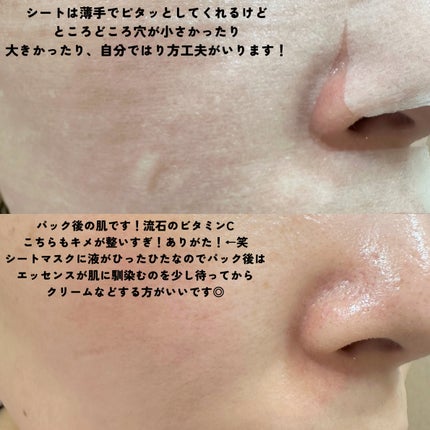 ルルルン ハイドラ AZ マスク/ルルルン/シートマスク・パックを使ったクチコミ(5枚目)
