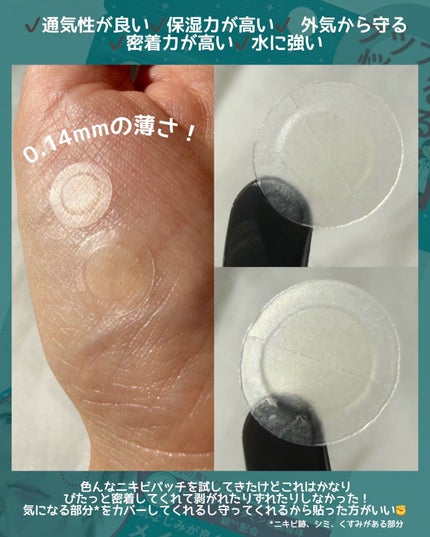 ゼロスポットパッチ/Today’s Cosme/にきびパッチを使ったクチコミ(3枚目)