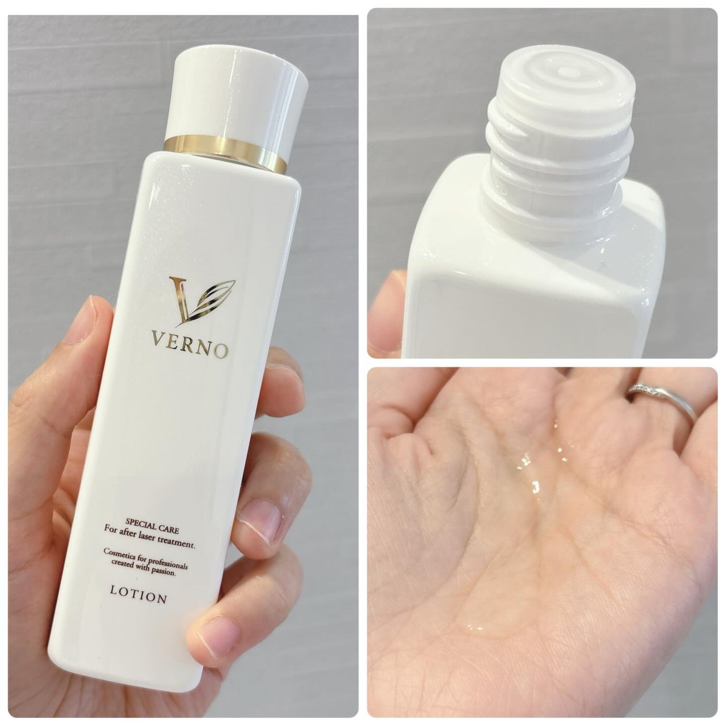 VERNO SKIN ローション〈医薬部外品〉/VERNO SKIN CARE/化粧水を使ったクチコミ(2枚目)