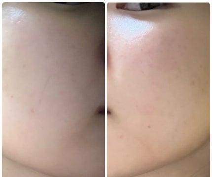 ぽむ on LIPS 「1枚目 2025.12.2エピデュオ 811日目2枚目 202..」(4枚目)