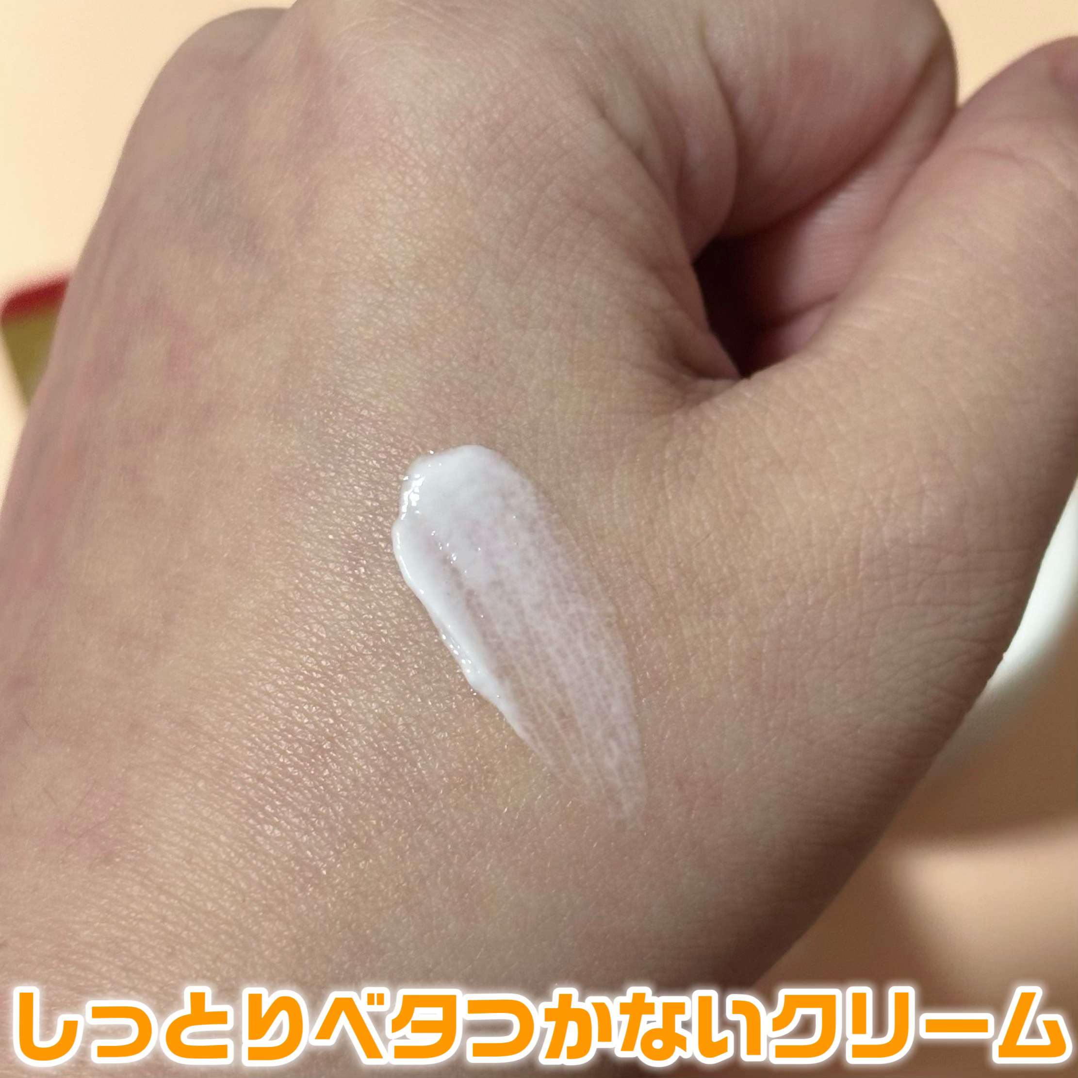 ヘパソフトプラス(医薬品) 85g（ジャー）/ロート製薬/その他を使ったクチコミ（2枚目）