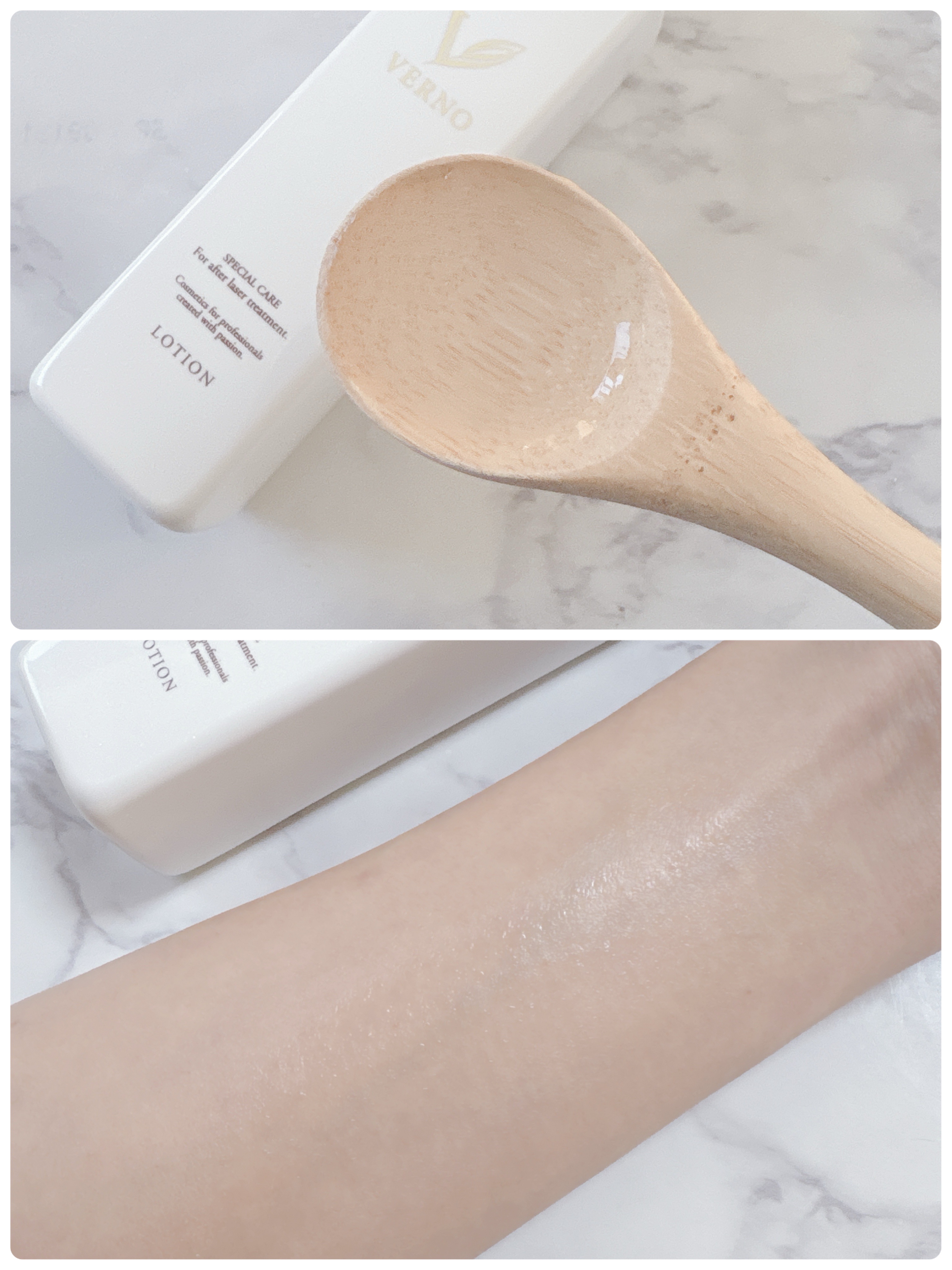 VERNO SKIN ローション〈医薬部外品〉/VERNO SKIN CARE/化粧水を使ったクチコミ（2枚目）