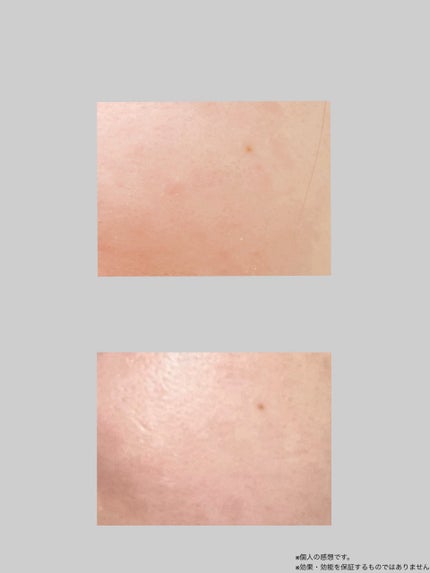 リードルショット100/VT/美容液を使ったクチコミ(4枚目)