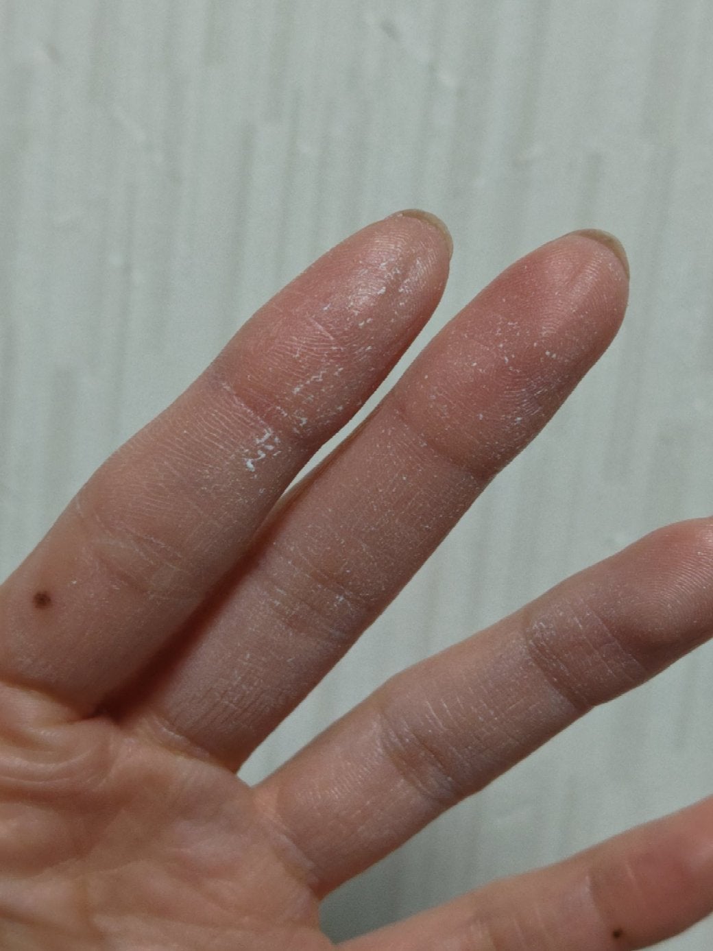 モグ クリーム/mogu/フェイスクリームを使ったクチコミ(5枚目)