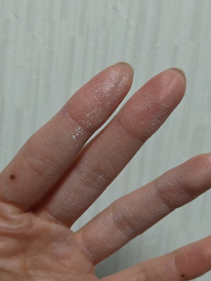 モグ クリーム/mogu/フェイスクリームを使ったクチコミ(5枚目)