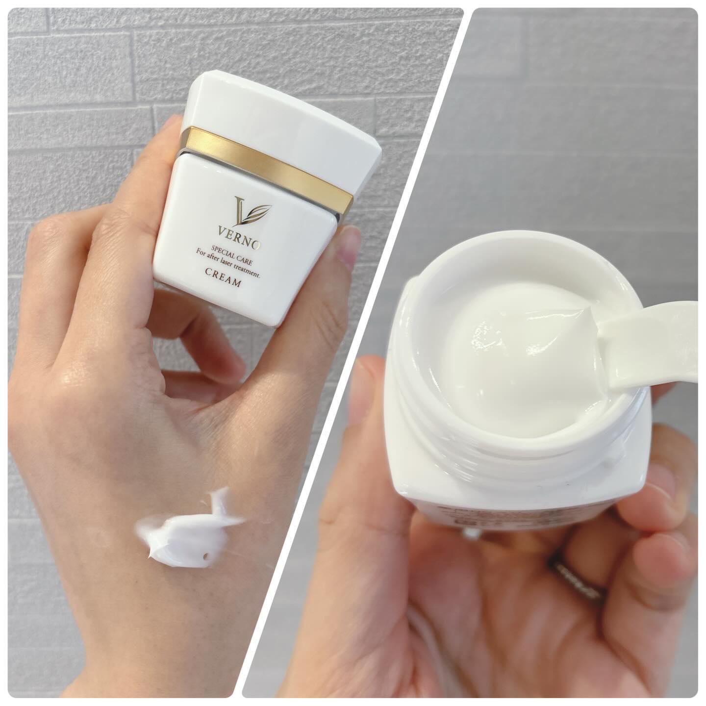 VERNO SKIN ローション〈医薬部外品〉/VERNO SKIN CARE/化粧水を使ったクチコミ（3枚目）