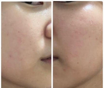 を使ったクチコミ(2枚目)