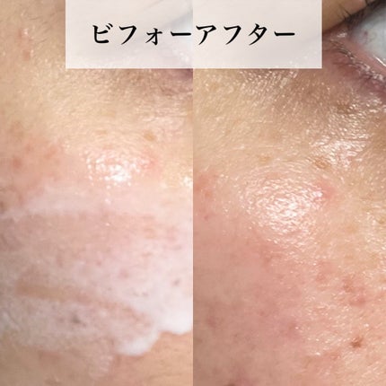 リードルS PDRN+ セラム/VT/美容液を使ったクチコミ(3枚目)