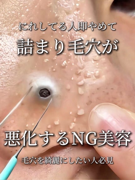 アネトス バランシング トリートメントクリーム/Anetos/フェイスクリームを使ったクチコミ(1枚目)