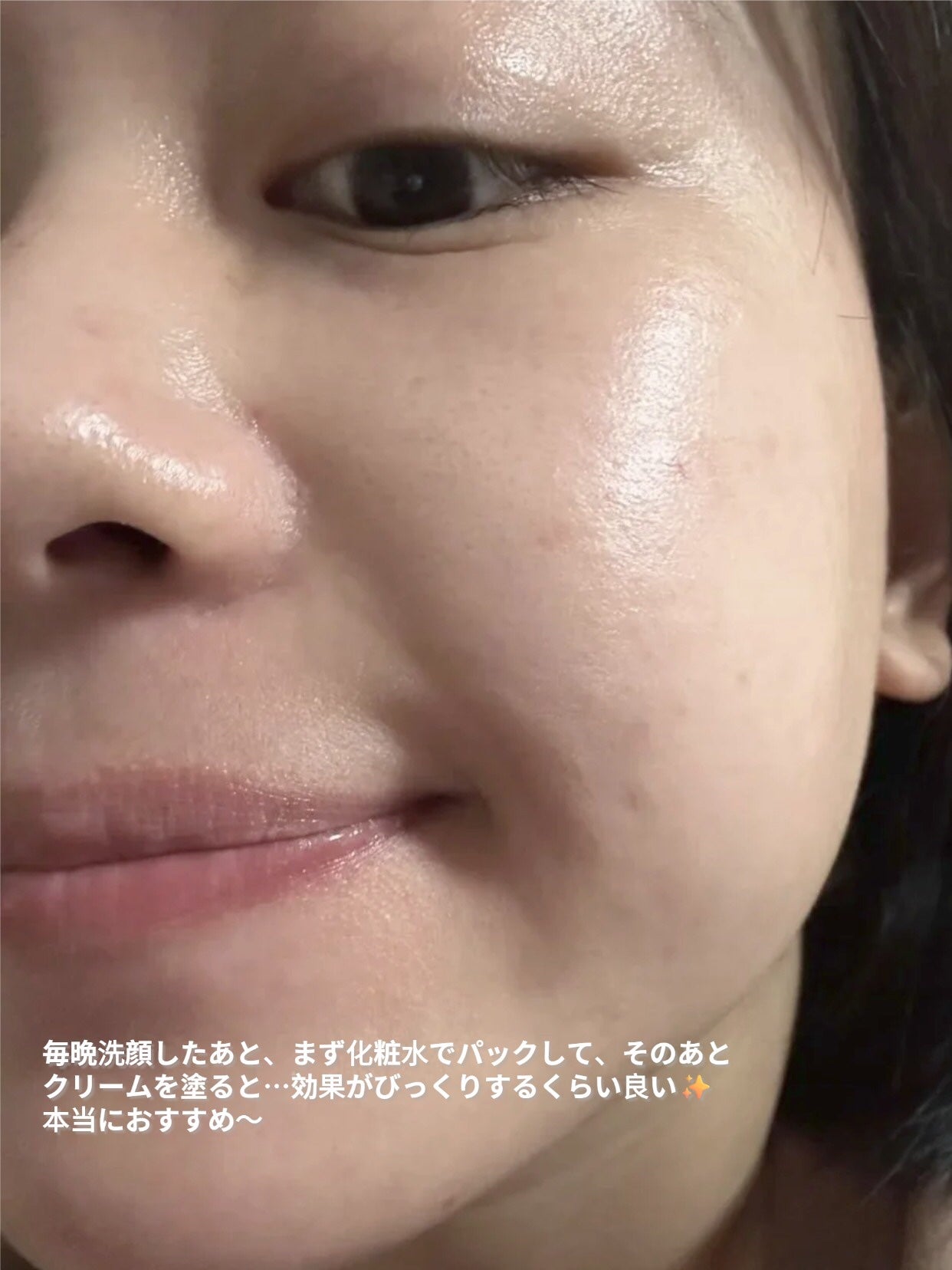 アネトス バランシング トリートメントクリーム/Anetos/フェイスクリームを使ったクチコミ(5枚目)