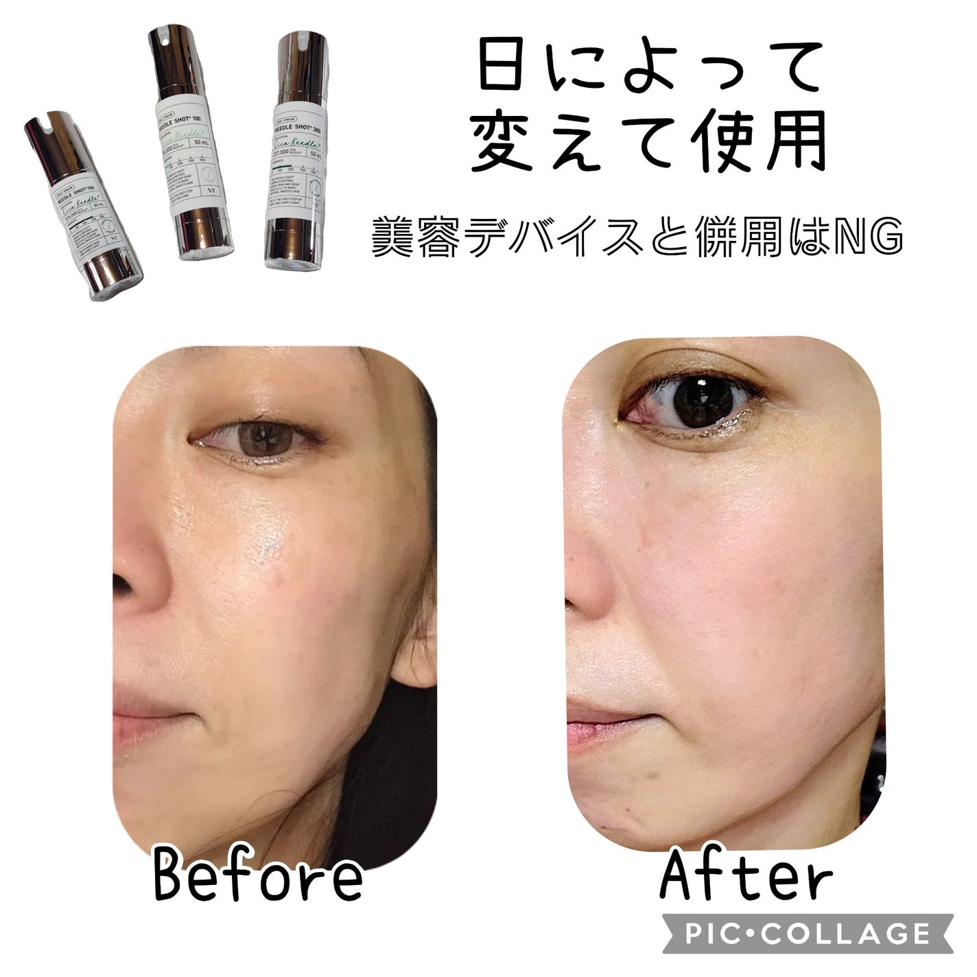 リードルショット100/VT/美容液を使ったクチコミ(5枚目)