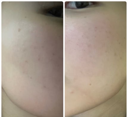 を使ったクチコミ(3枚目)