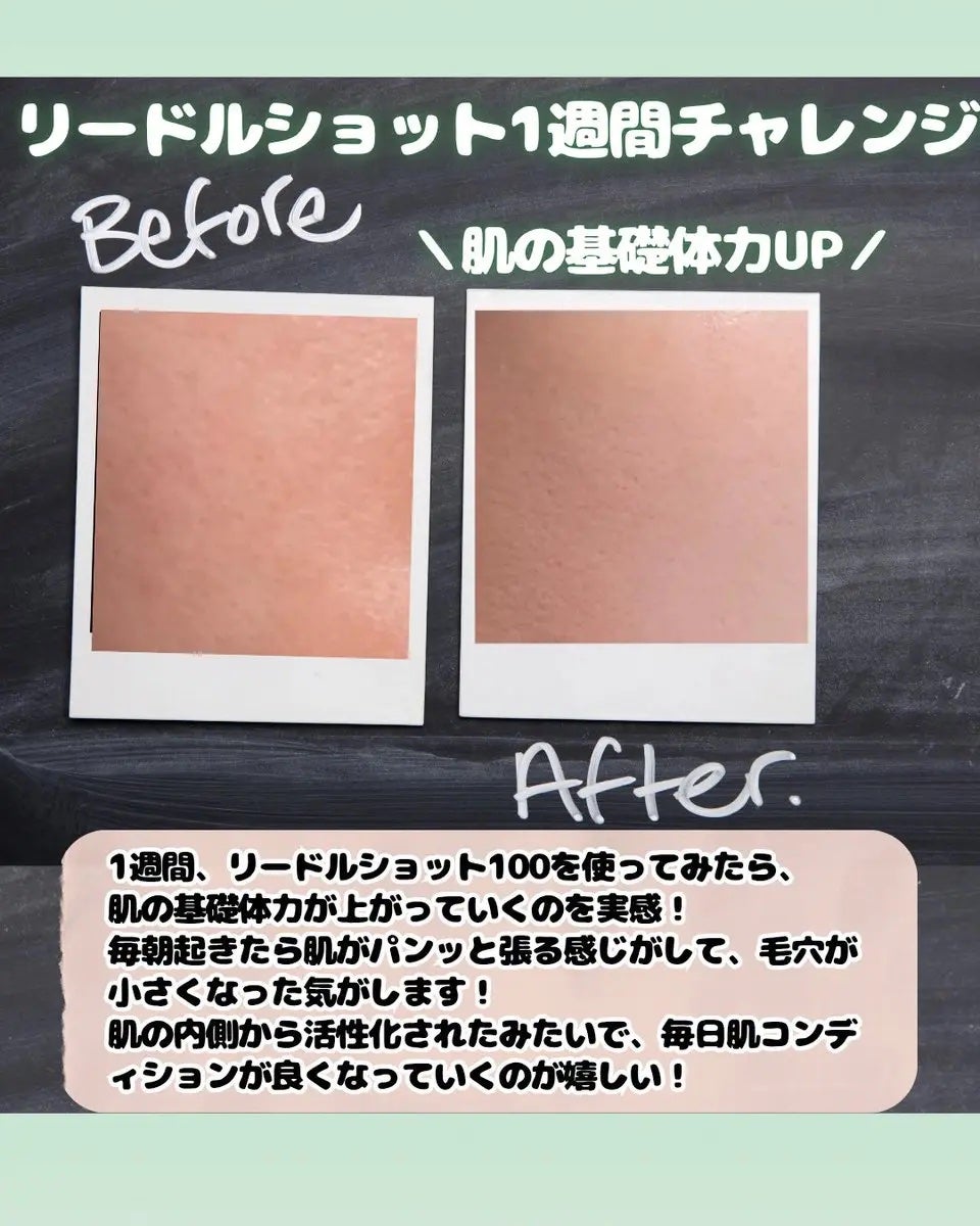 リードルショット100/VT/美容液を使ったクチコミ(4枚目)