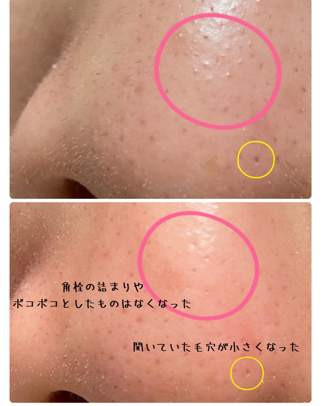 きなこ フォロバ100🫶 on LIPS 「こんにちは!きなこです!今日はドラッグストアでたまたま目に入っ..」(2枚目)