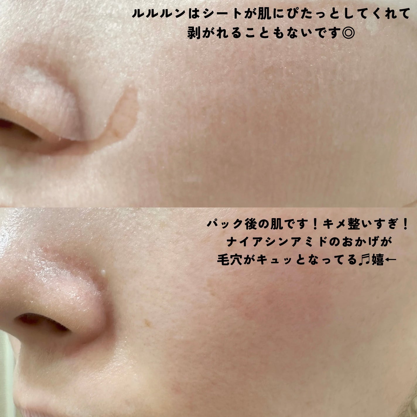 ルルルン ハイドラ AZ マスク/ルルルン/シートマスク・パックを使ったクチコミ(3枚目)