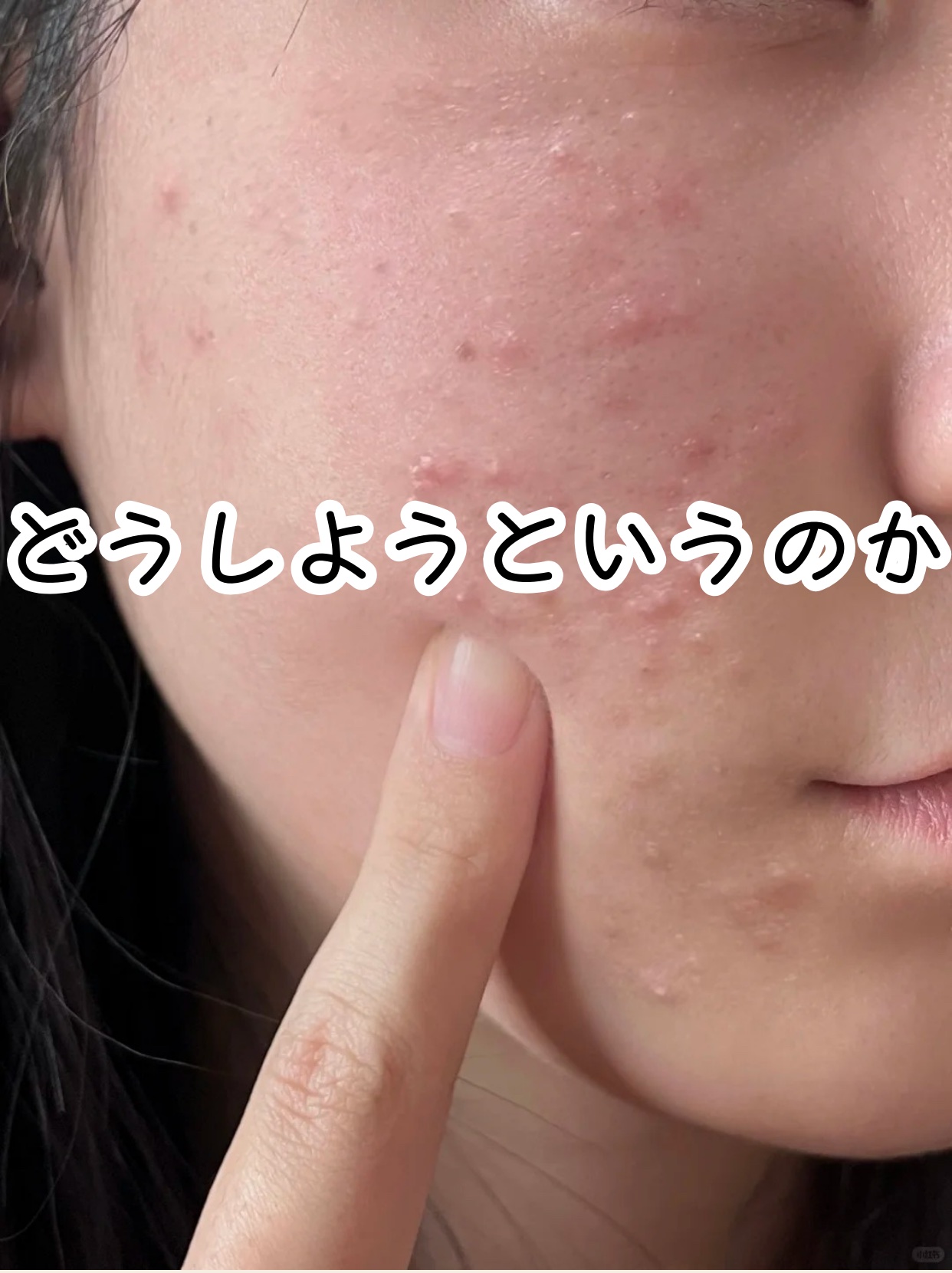 アネトス バランシング トリートメントクリーム/Anetos/フェイスクリームを使ったクチコミ（1枚目）