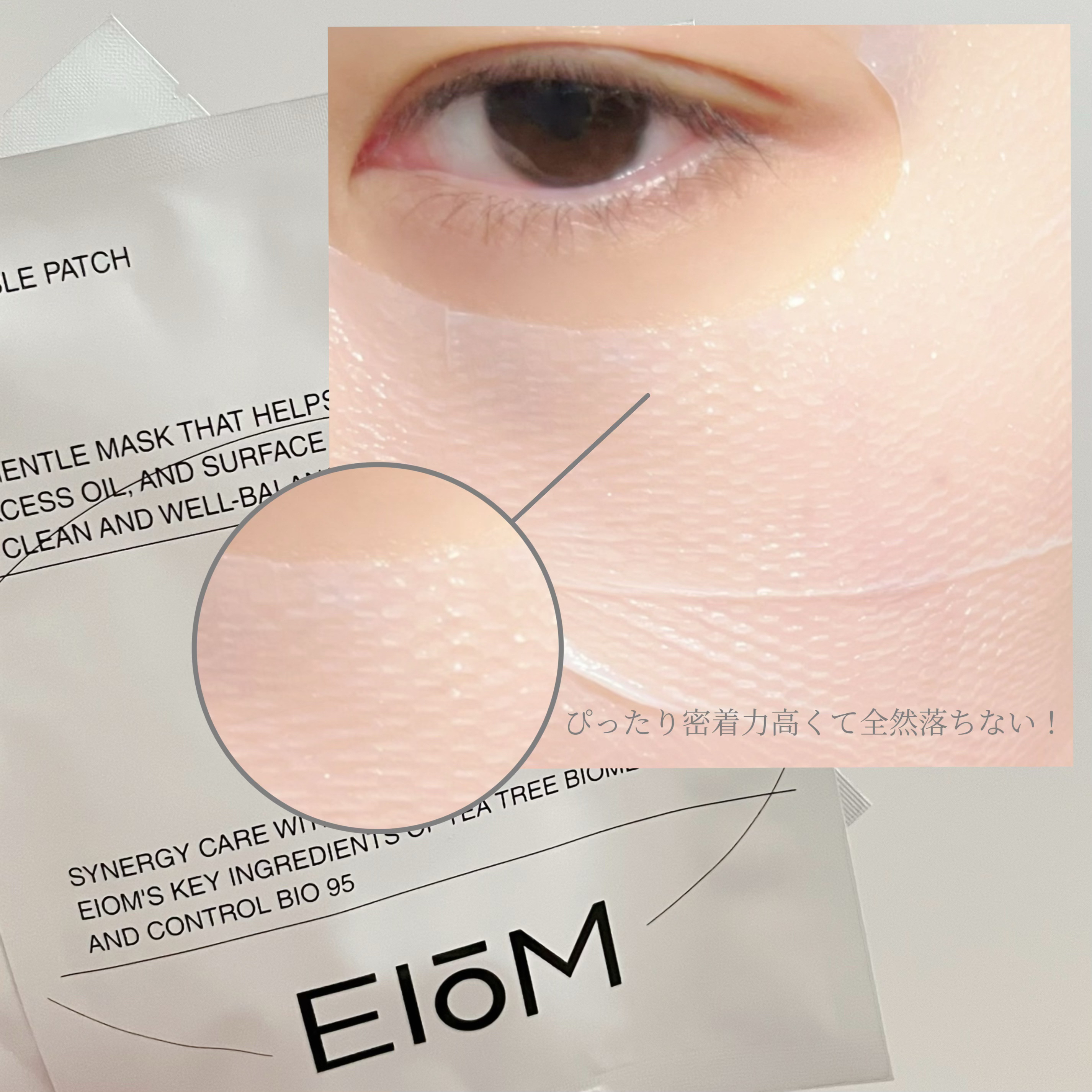 トラブルパッチマスク/EIOM/その他スキンケアを使ったクチコミ（3枚目）