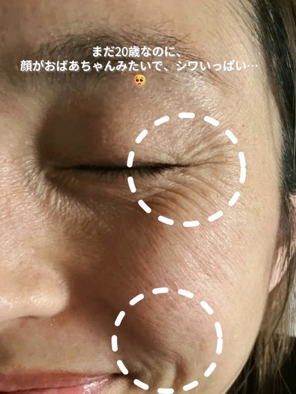 アネトス バランシング トリートメントクリーム/Anetos/フェイスクリームを使ったクチコミ(2枚目)