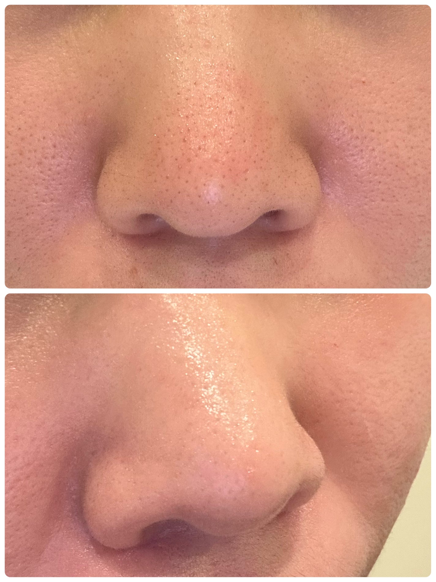 ビタミンミルク/ASUNE /乳液を使ったクチコミ(2枚目)