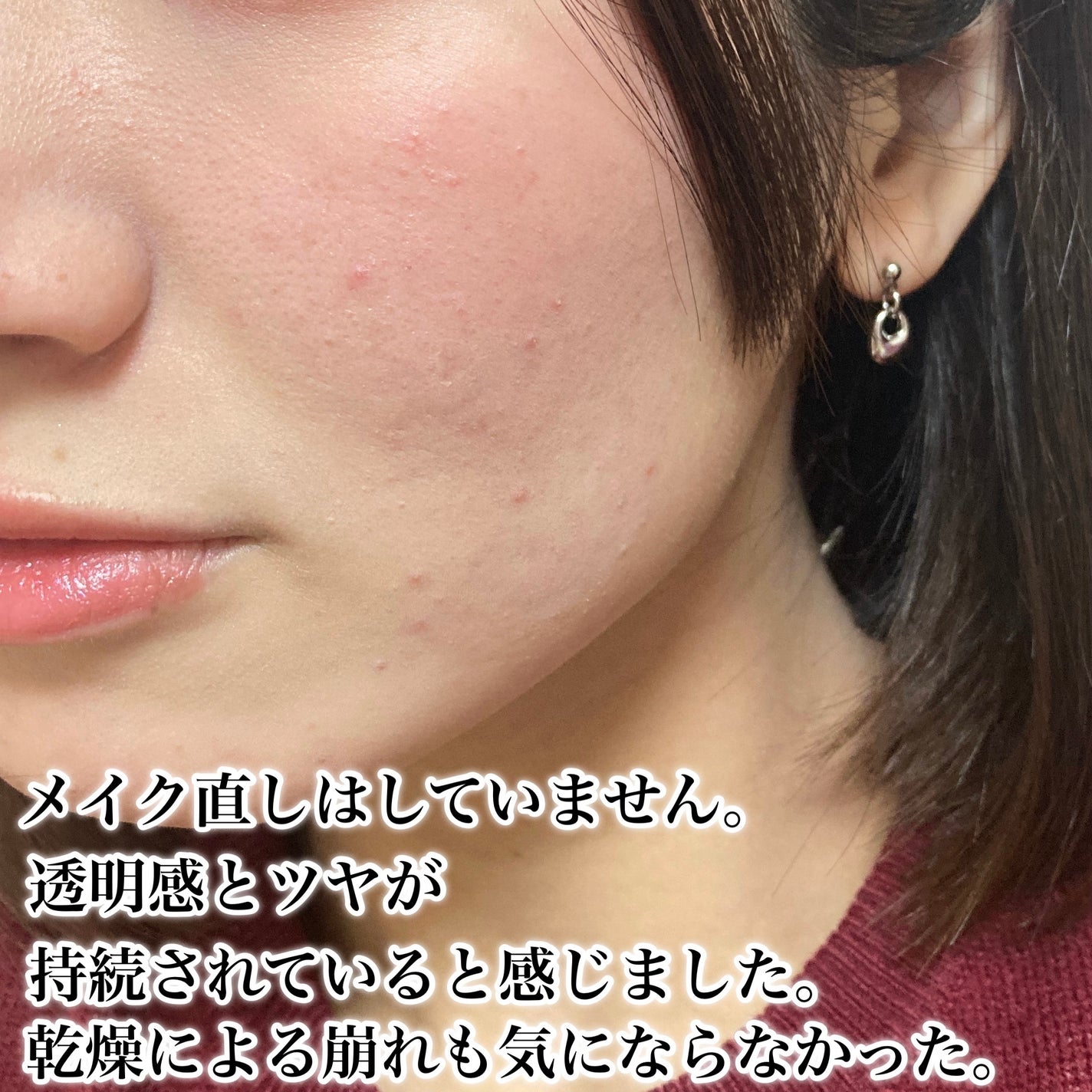 エッセンス スキングロウ ファンデーション/SHISEIDO/リキッドファンデーションを使ったクチコミ(6枚目)