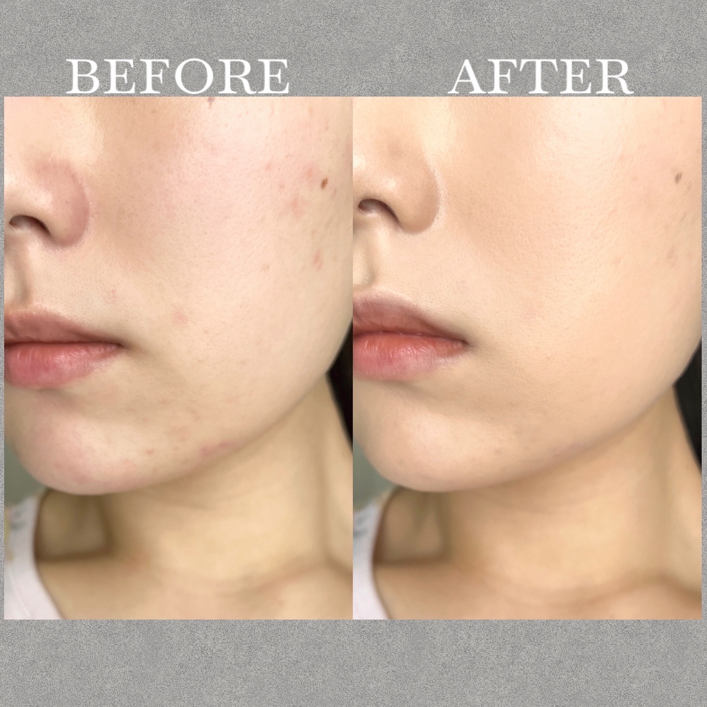 アイシーフィットカバークッションEX/TFIT/クッションファンデーションを使ったクチコミ（3枚目）