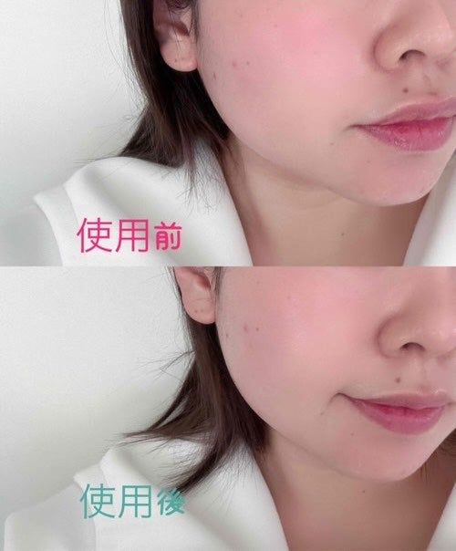 雲丹ちゃん🐰フォロバ100 on LIPS 「最近"セルフホームケア"にちょうど良いOableAuthent..」(4枚目)