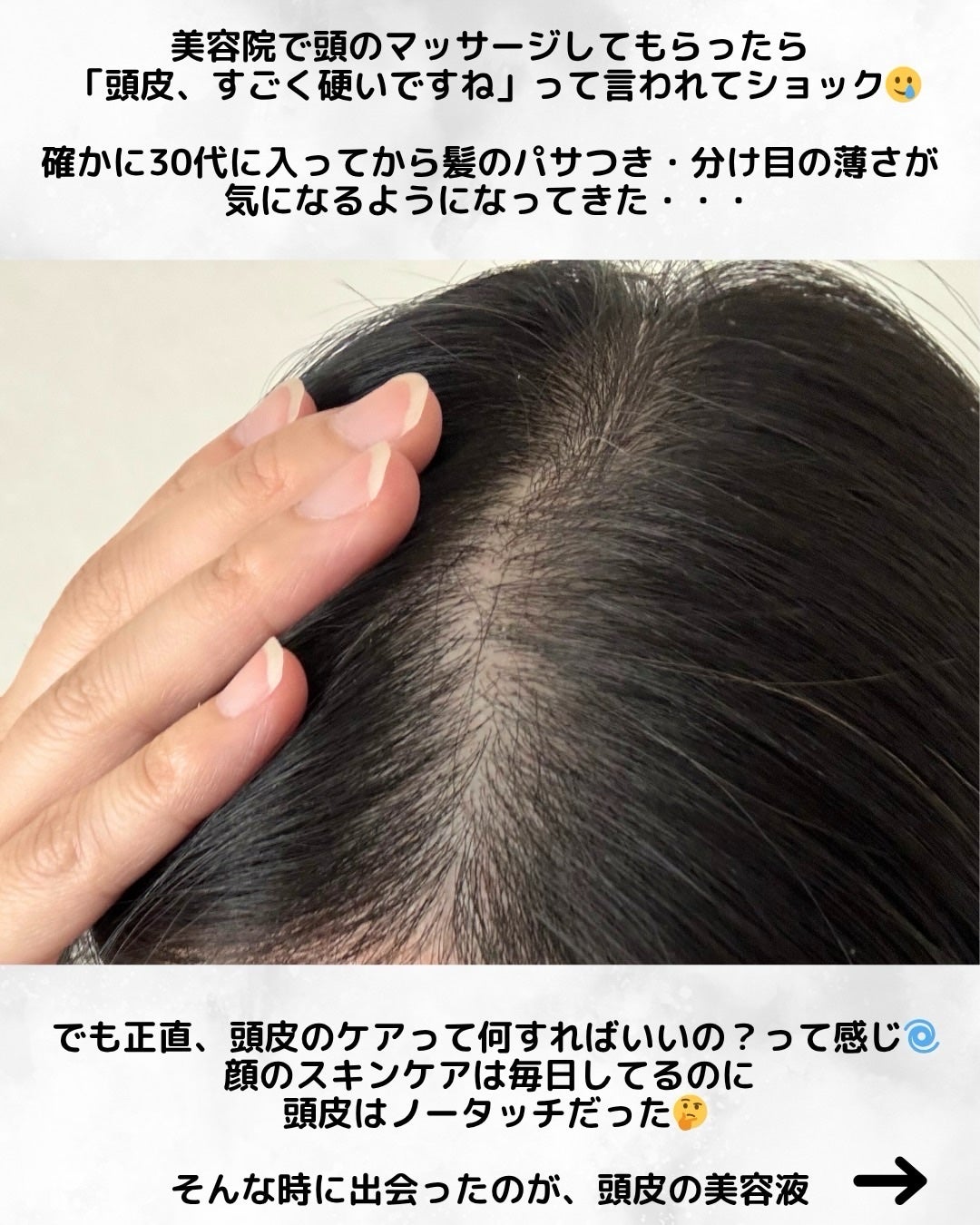 薬用育毛ローション RANMU/RANMU/頭皮ローションを使ったクチコミ(2枚目)