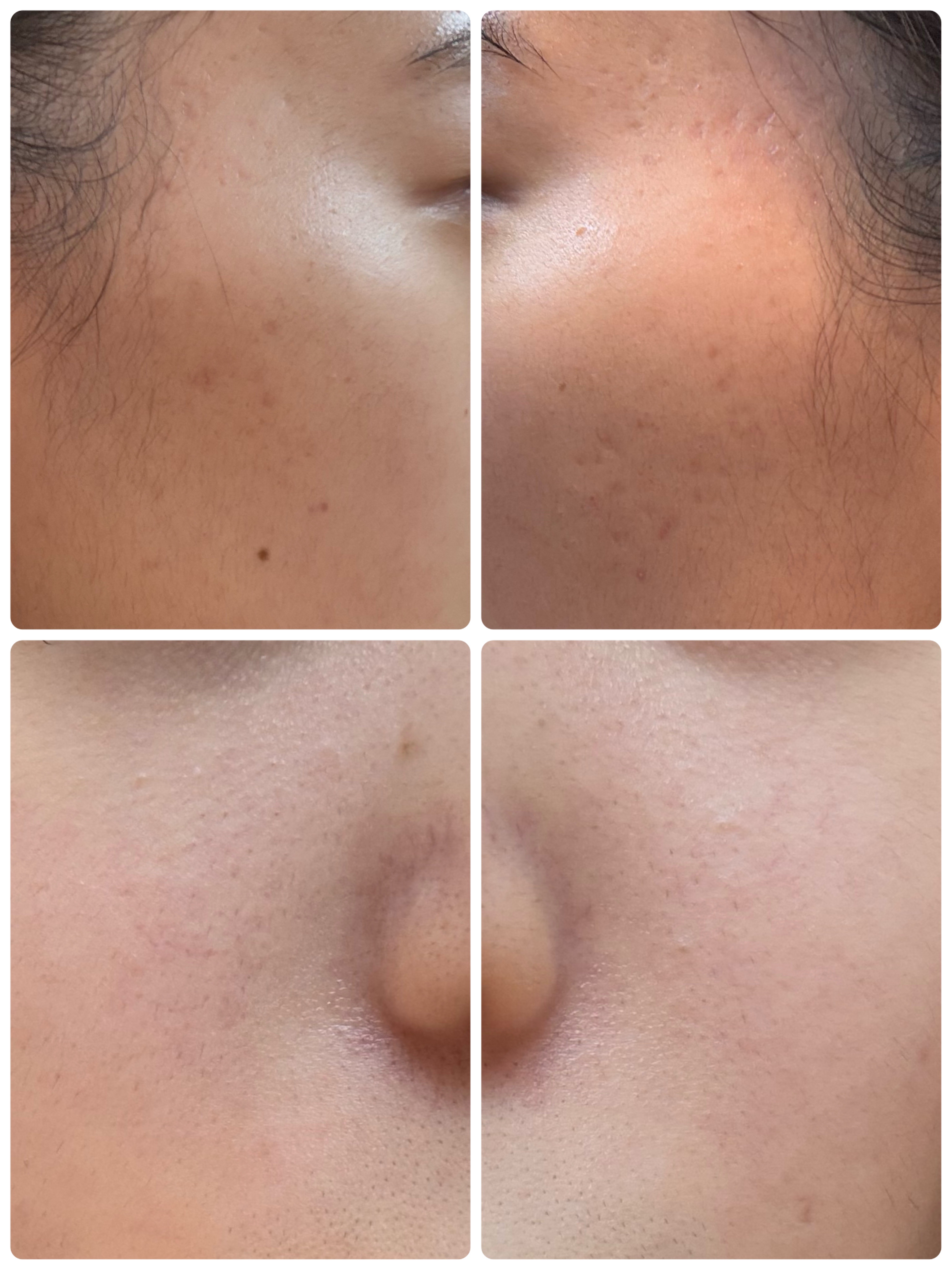 モーニングジェルウォッシュ/ビトレスキン/その他洗顔料を使ったクチコミ（2枚目）