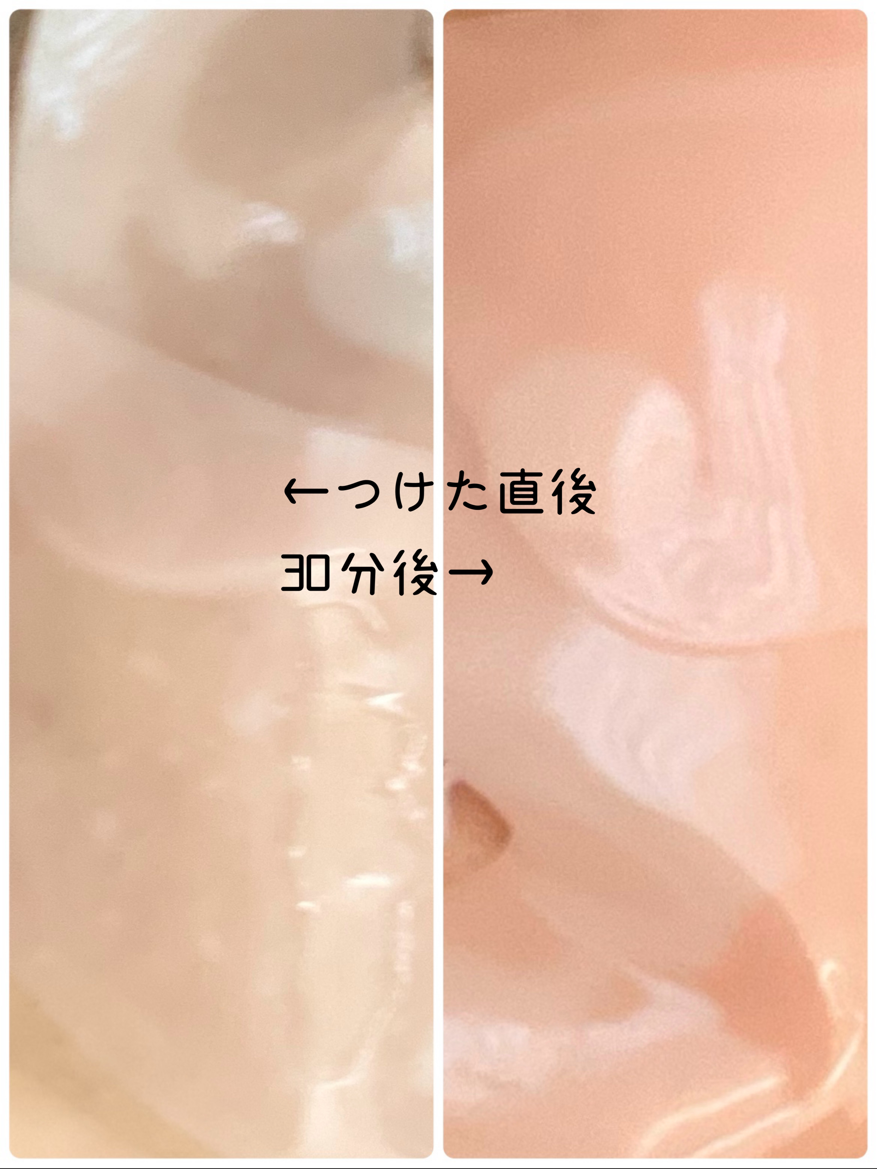 PDRNリジュべネティングフルインハイドロゲルマスク/SAM'U/シートマスク・パックを使ったクチコミ（3枚目）