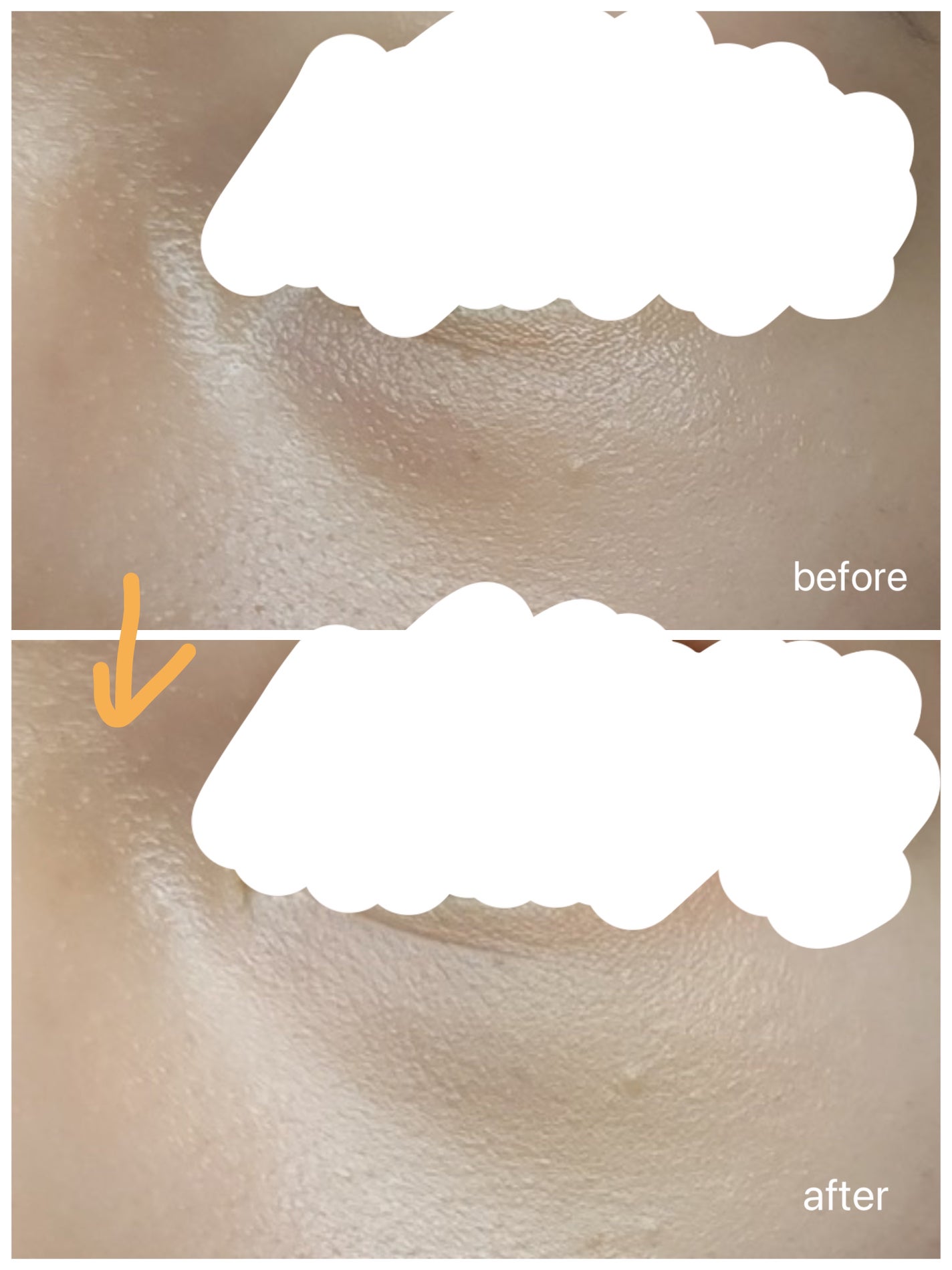 パレットコンシーラー ハイカバー/CEZANNE/パレットコンシーラーを使ったクチコミ(4枚目)