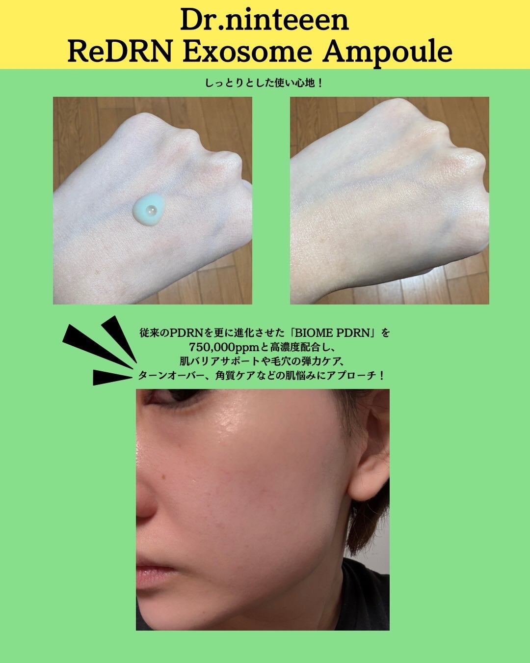 ReDRNエクソソームアンプル/Dr.nineteen/美容液を使ったクチコミ(2枚目)
