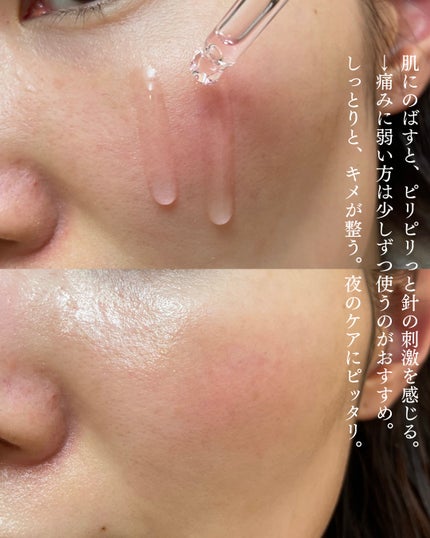 ピンクトーニング™︎ディープインショットアンプル/CNP Laboratory/美容液を使ったクチコミ(4枚目)