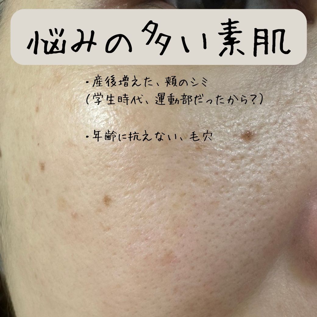 G3ナイアシンセラム/urbanand/美容液を使ったクチコミ（3枚目）