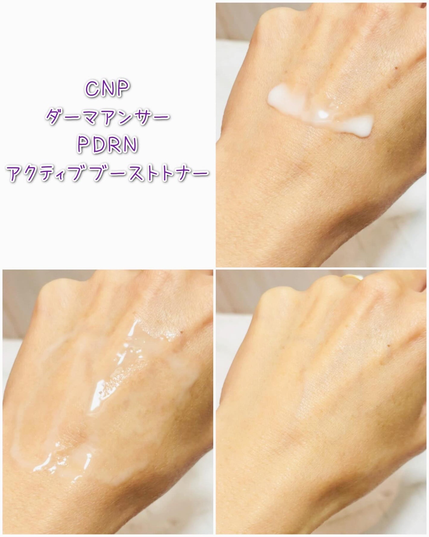 ダーマアンサーPDRNトナー/CNP Laboratory/化粧水を使ったクチコミ(3枚目)