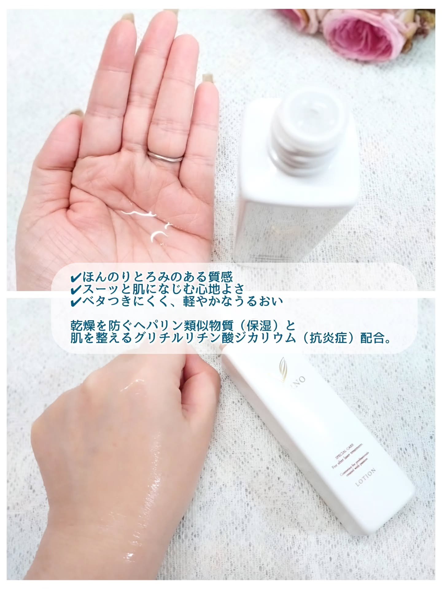 VERNO SKIN ローション〈医薬部外品〉/VERNO SKIN CARE/化粧水を使ったクチコミ（2枚目）