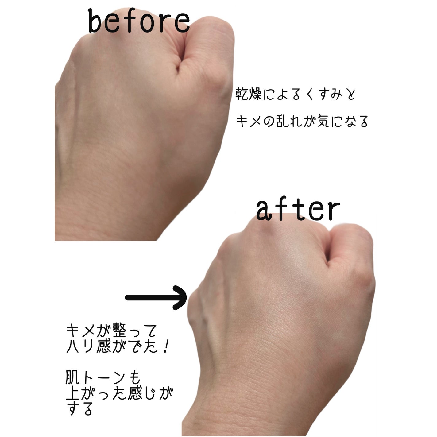 ディープエフェクトスピキュレーションエッセンス/Dr's Touch/美容液を使ったクチコミ(4枚目)