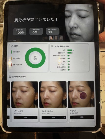 キールズ DS ライン ミルクピール トナー/Kiehl's/化粧水を使ったクチコミ(5枚目)