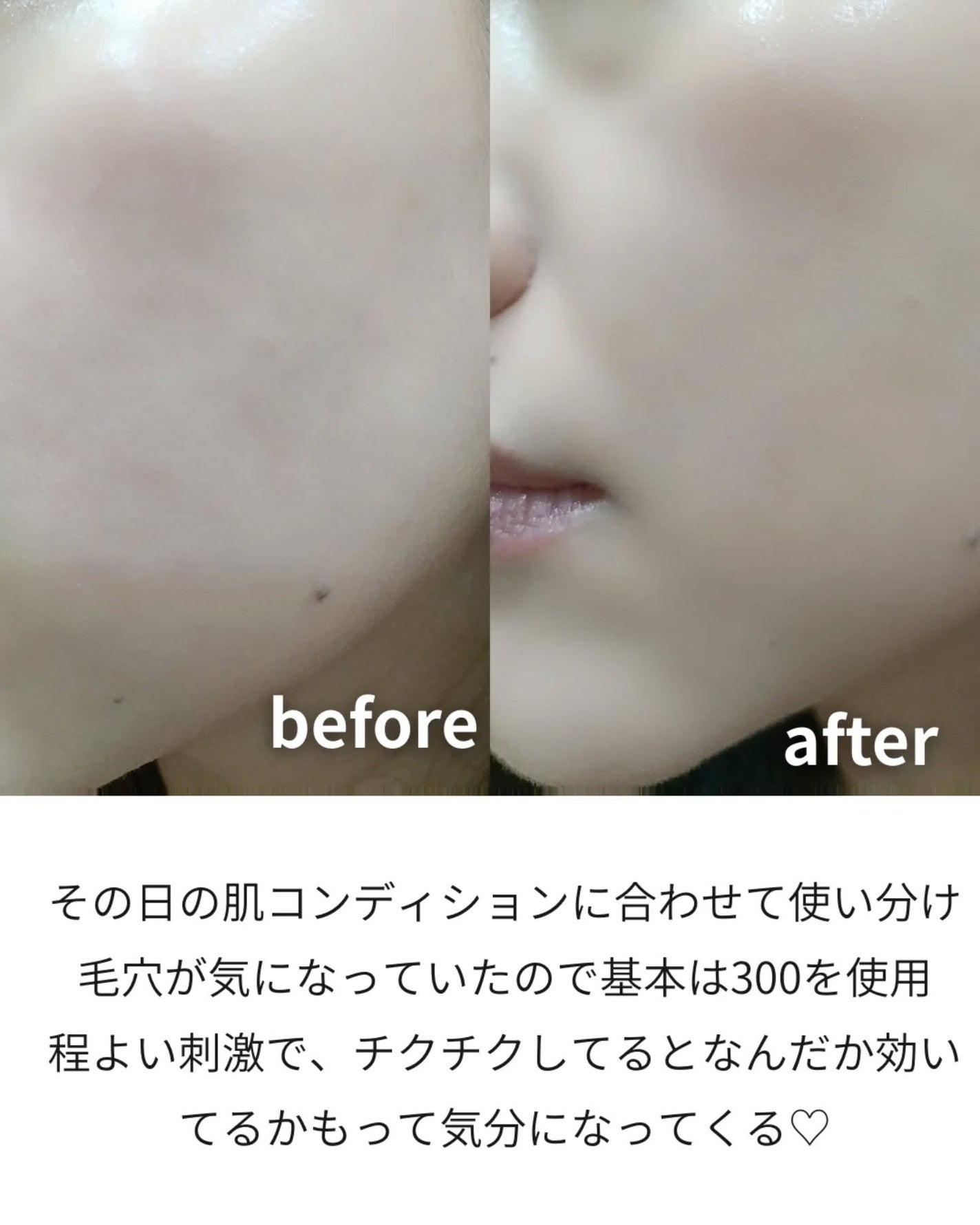 リードルショット100/VT/美容液を使ったクチコミ(4枚目)