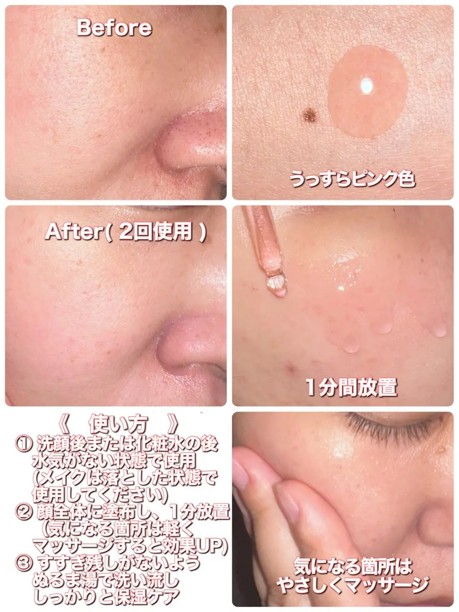 AHA 9.12 オミジャ 陶器肌 ウォッシュオフ セラム/parnell/美容液を使ったクチコミ（2枚目）