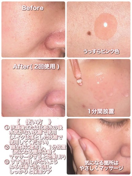 AHA 9.12 オミジャ 陶器肌 ウォッシュオフ セラム/parnell/美容液を使ったクチコミ(2枚目)