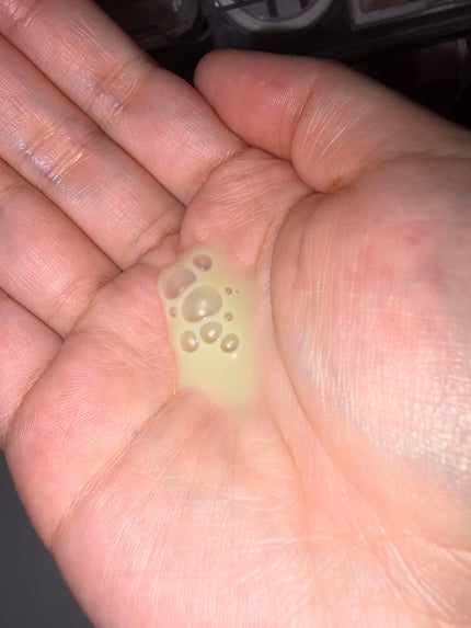 PDRNエキスパートテンションターゲットセラム/SAM'U/美容液を使ったクチコミ(4枚目)