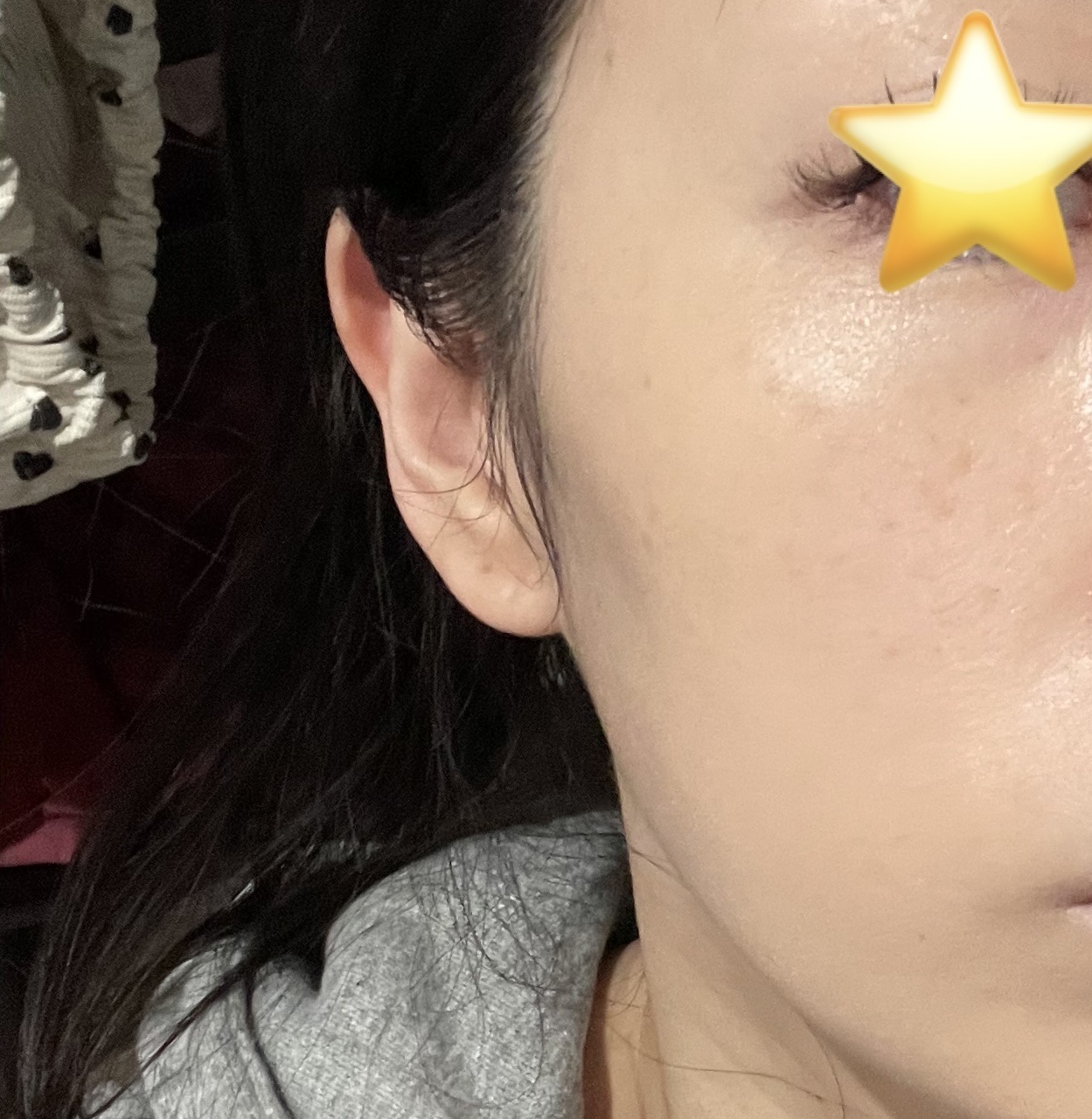 PDRNヒアルロン酸カプセル100セラム/Anua/美容液を使ったクチコミ（3枚目）