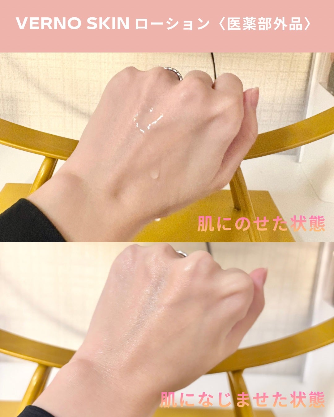 VERNO SKIN ローション〈医薬部外品〉/VERNO SKIN CARE/化粧水を使ったクチコミ(3枚目)